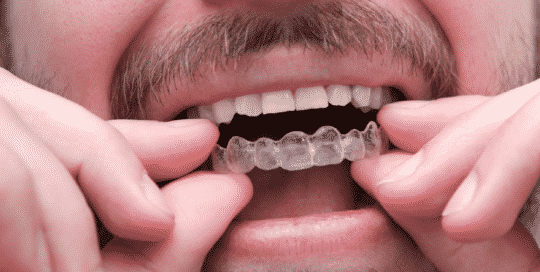 Teeth Straightening Parkway Clinic