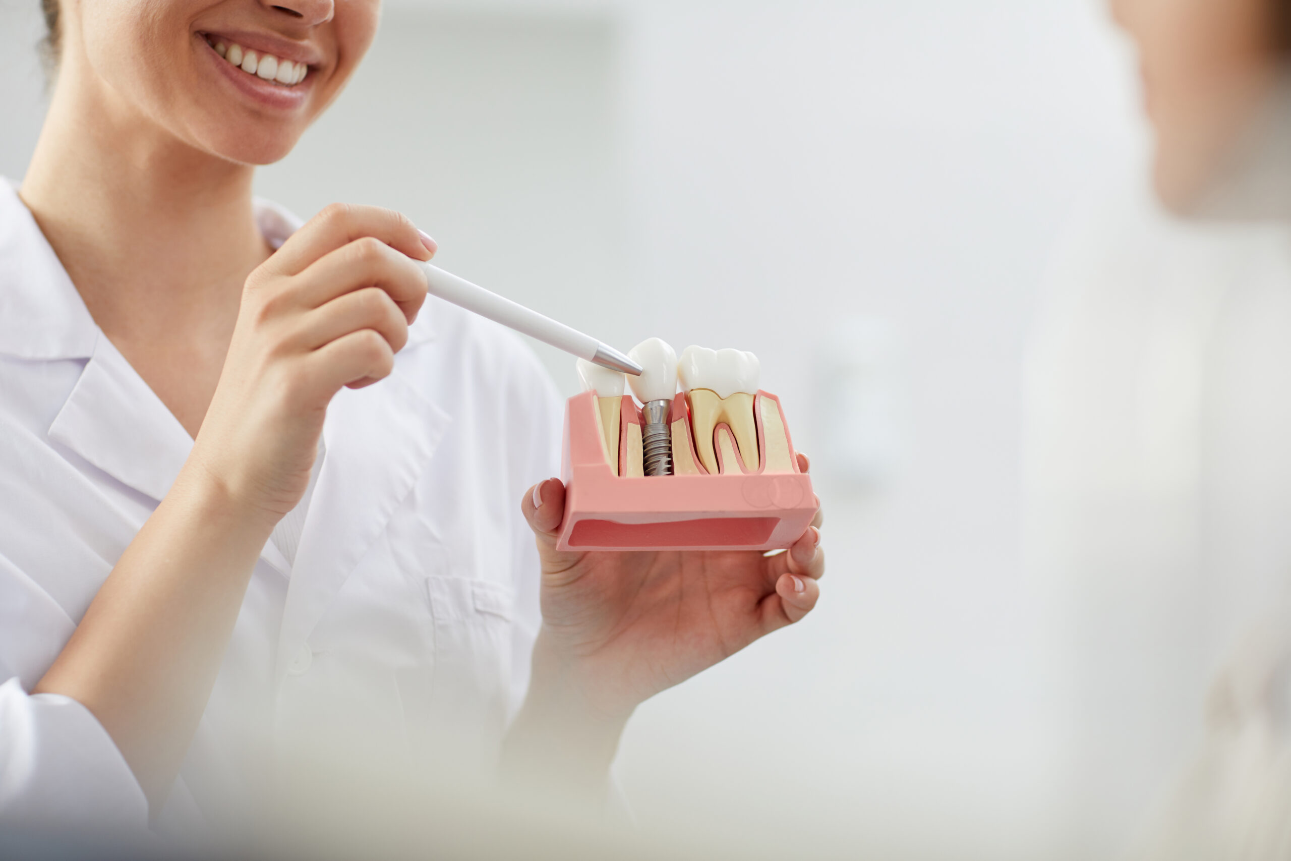 Dental Implant - Parkway Clinic