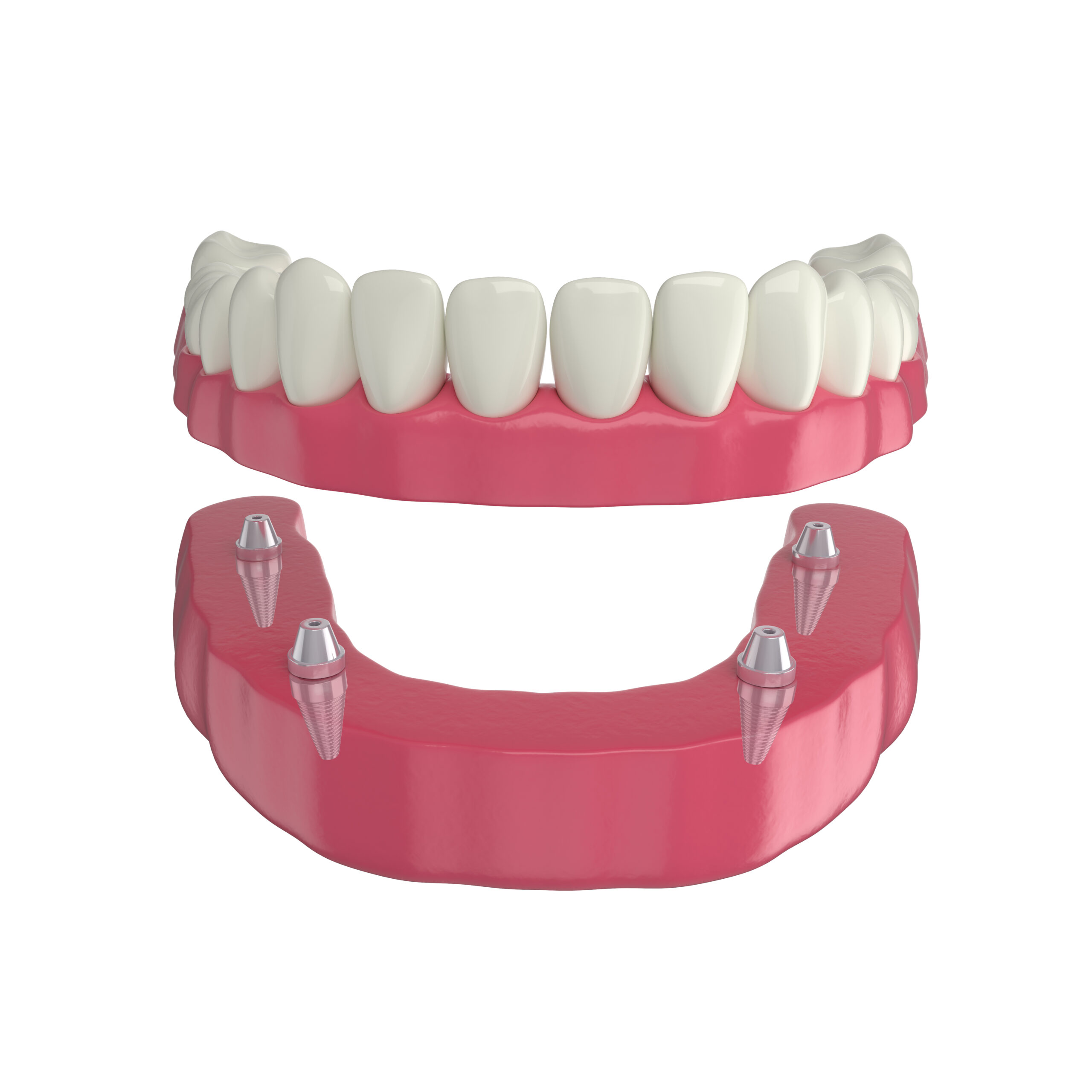 Dentures Parkway Clinic 4